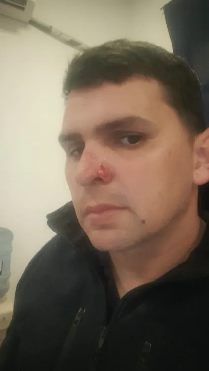 policia herido